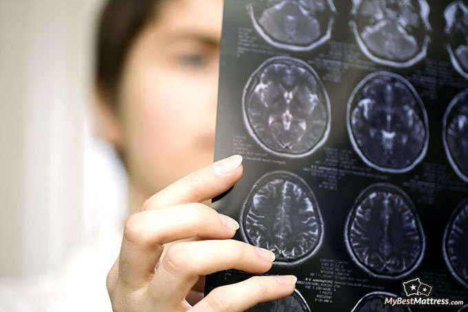 what is narcolepsy: brain scan