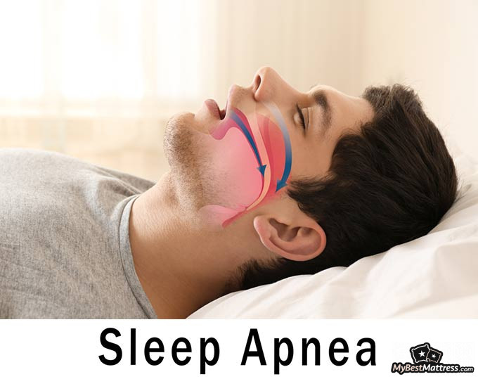 what is the disease called when you sleep all the time what is the disease called when you sleep all the time