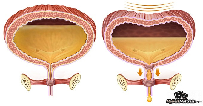 How to get urine out of a mattress: urethra How to get urine out of a mattress: urethra